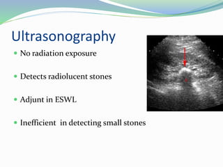 Ultrasonography
 No radiation exposure
 Detects radiolucent stones
 Adjunt in ESWL
 Inefficient in detecting small stones
 