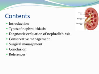 Contents
 Introduction
 Types of nephrolithiasis
 Diagnostic evaluation of nephrolithiasis
 Conservative management
 Surgical management
 Conclusion
 References
 