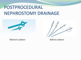 POSTPROCEDURAL
NEPHROSTOMY DRAINAGE
Malecot’s catheter Balloon catheter
 