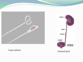 Cope catheter
Ureteral stent
 