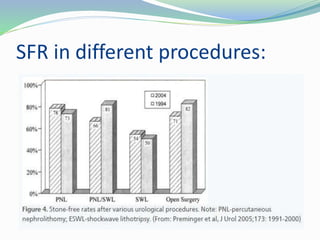 SFR in different procedures:
 