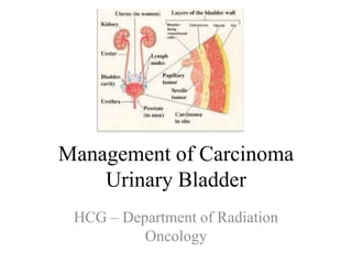 Management of Carcinoma
Urinary Bladder
HCG – Department of Radiation
Oncology
 