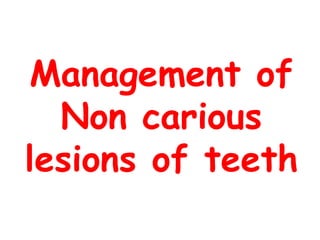 Management of
Non carious
lesions of teeth

 