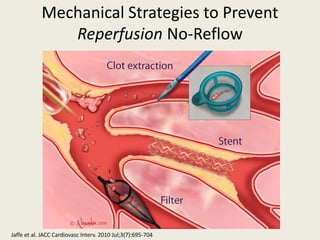 Management of no reflow | PPTX