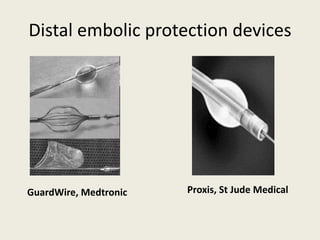 Guardwire Management of no reflow | PPTX