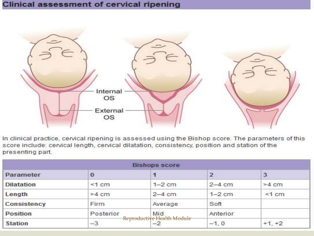 Management Of Normal Labor : The stages of labour and birth – KJDNPR