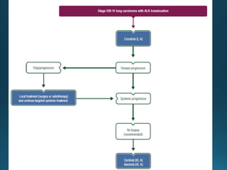 Management of Non Small Cell Lung Cancers | PPTX