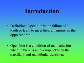 Introduction
• Definition: Open bite is the failure of a
tooth or teeth to meet their antagonist in the
opposite arch.
• Open bite is a condition of malocclusion
wherein there is an overlap between the
maxillary and mandibular dentition.
 