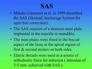SAS
• Mikako Umemori et al. in 1999 described
the SAS (Skeletal Anchorage System for
open bite correction).
• The SAS consists of a titanium mini plate
implanted in the maxilla or mandible.
• The mini plates were fixed in the buccal
aspect of the bone at the apical region of
first & second molars on both sides.
• Elastic threads were used as a source of
orthodontic force for intrusion ( intrusion of
3-5 mm. achieved with SAS ).
 