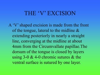 THE ‘V’ EXCISION
A ‘V’ shaped excision is made from the front
of the tongue, lateral to the midline &
extending posteriorly in nearly a straight
line, converging at the midline at about
4mm from the Circumvallate papillae.The
dorsum of the tongue is closed by layers
using 3-0 & 4-0 chromic sutures & the
ventral surface is sutured by one layer.
 