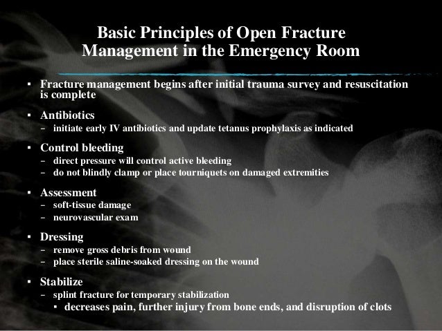 open vs closed fracture open vs closed fracture