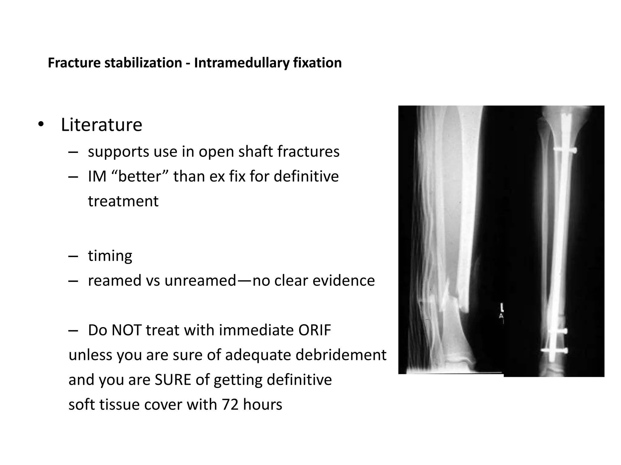 Management of open fractures final | PPTX