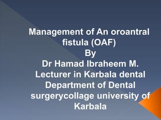 Management of An oroantral
fistula (OAF)
By
Dr Hamad Ibraheem M.
Lecturer in Karbala dental
Department of Dental
surgerycollage university of
Karbala
 