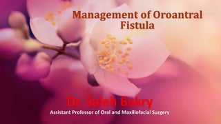Management of Oroantral
Fistula
Dr. Saleh Bakry
Assistant Professor of Oral and Maxillofacial Surgery
 