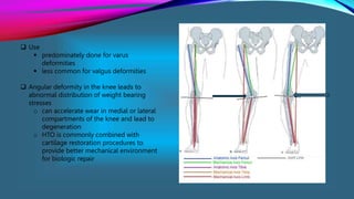 Varus Load Management of Osteoarthritis of the Knee last.pptx