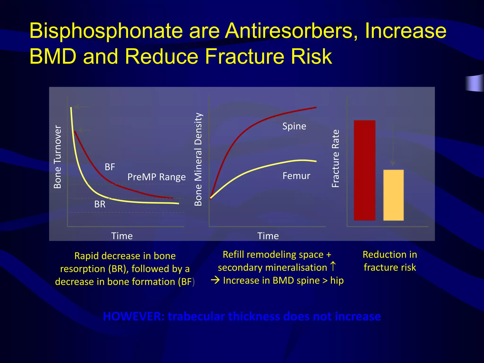Management of osteoporosis | PPT
