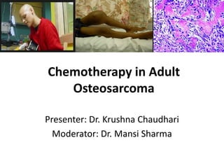 Chemotherapy in Adult
Osteosarcoma
Presenter: Dr. Krushna Chaudhari
Moderator: Dr. Mansi Sharma
 