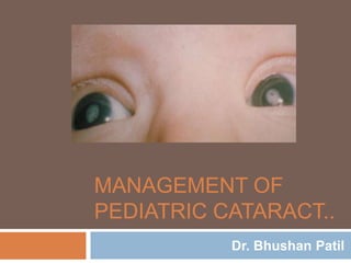 MANAGEMENT OF
PEDIATRIC CATARACT..
Dr. Bhushan Patil

 