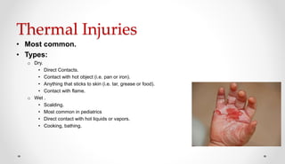 Tar Injury managementofpatientwithburns-171104103102.pptx