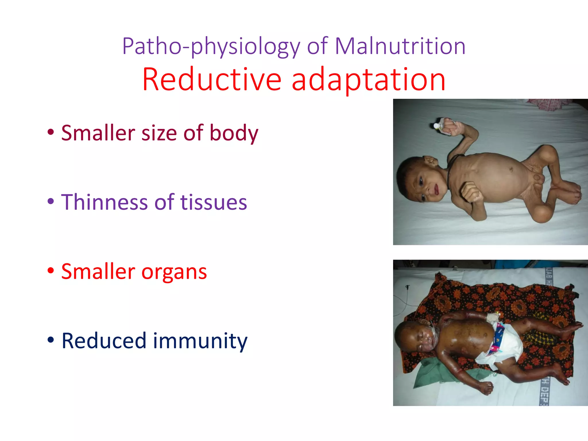 Management of pcm and sam 2021