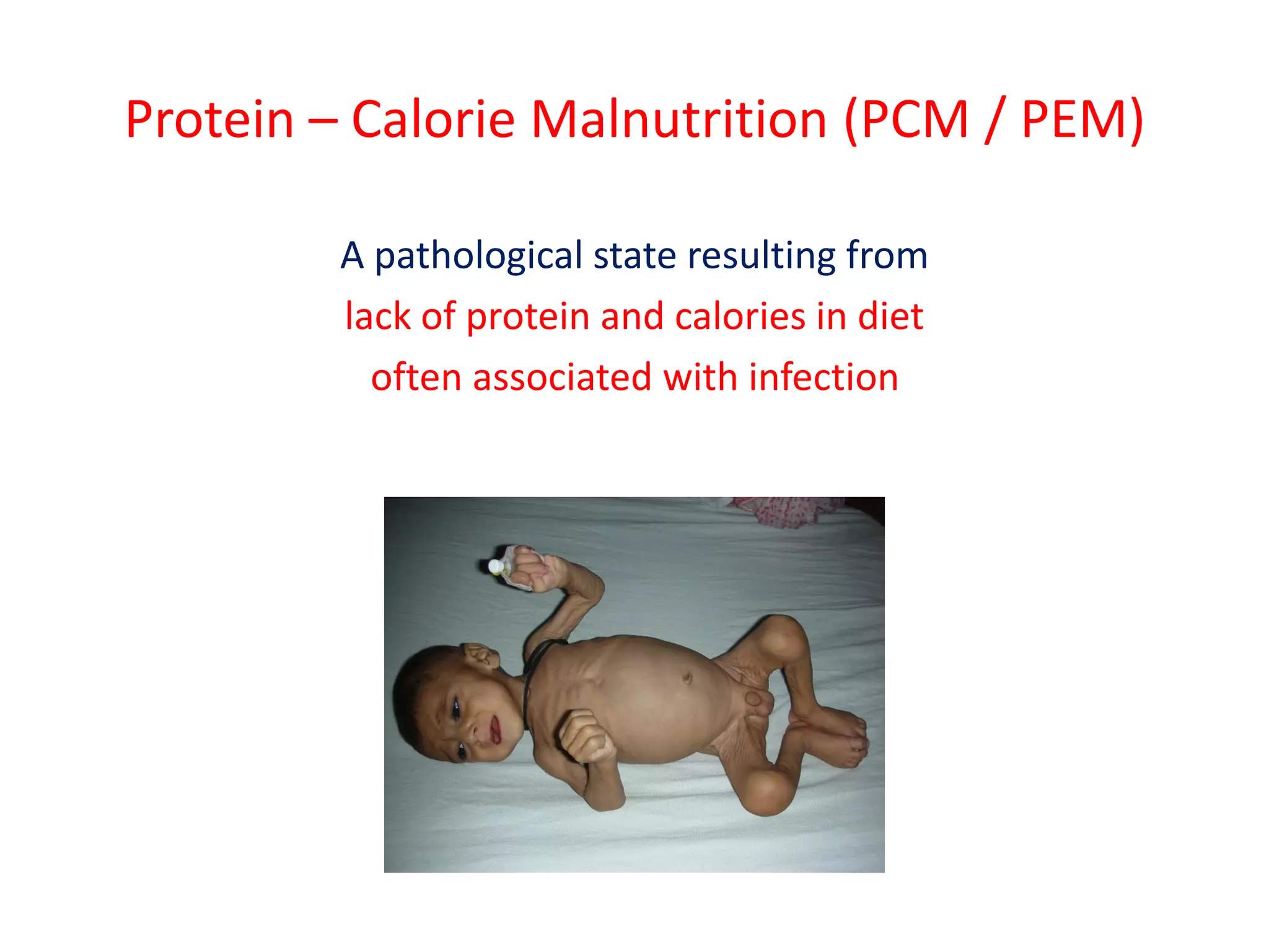 Management of pcm and sam 2021