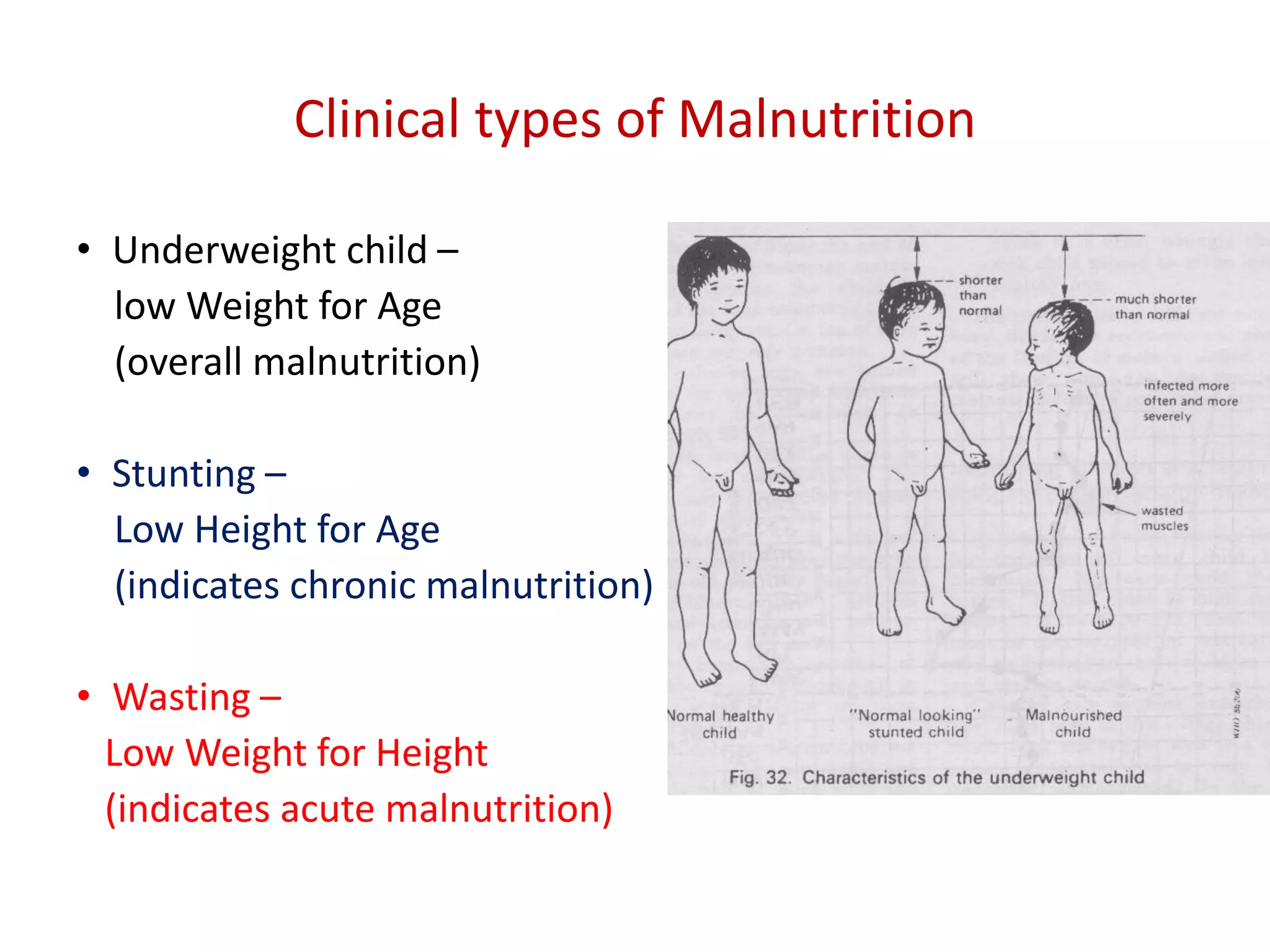 Management of pcm and sam 2021