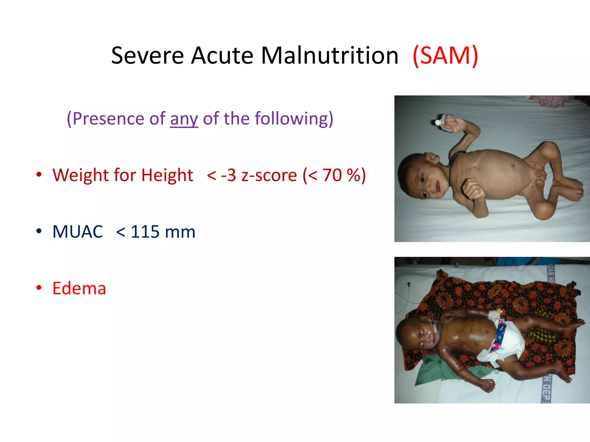 Management of pcm and sam 2021