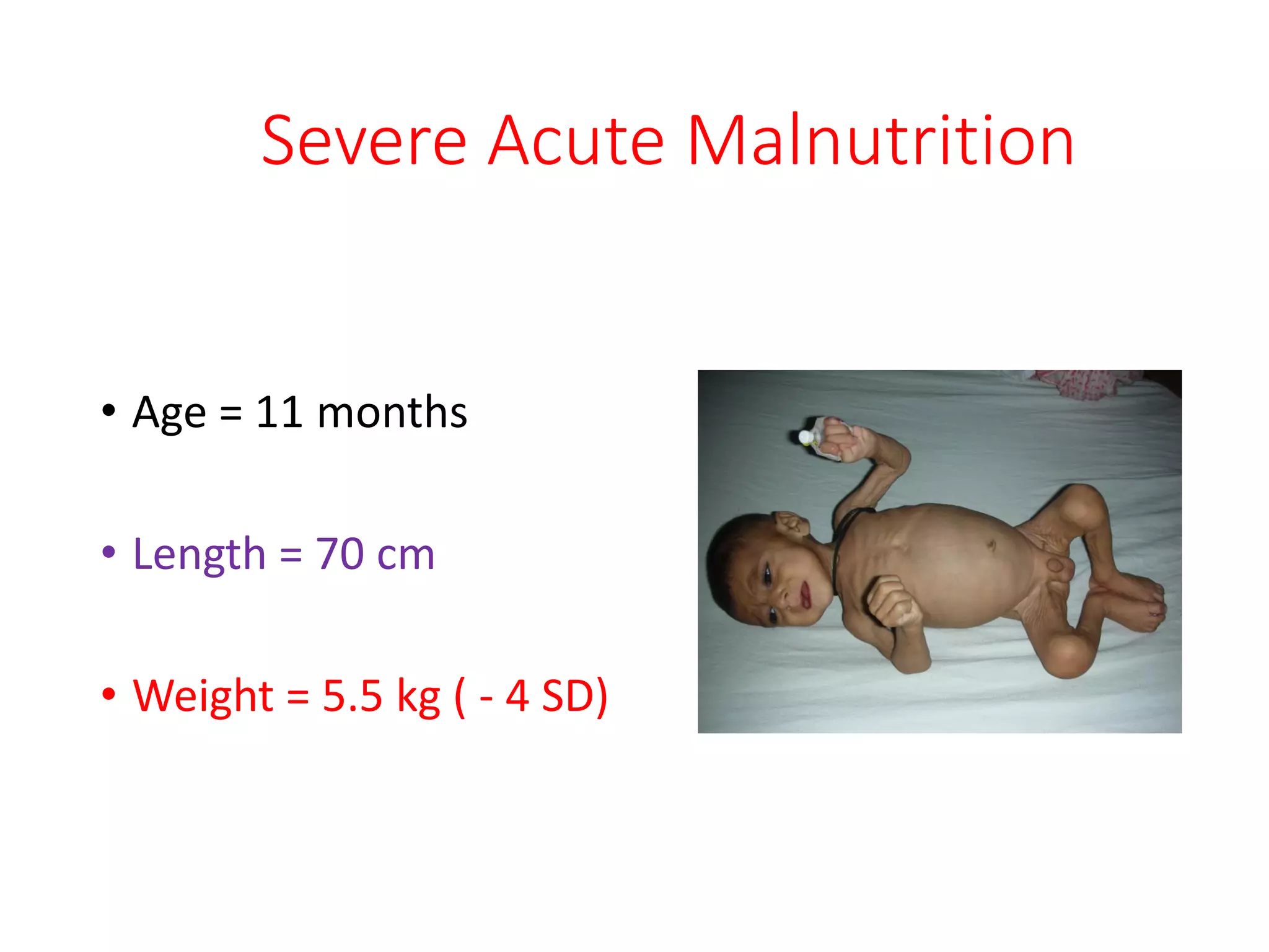 Management of pcm and sam 2021