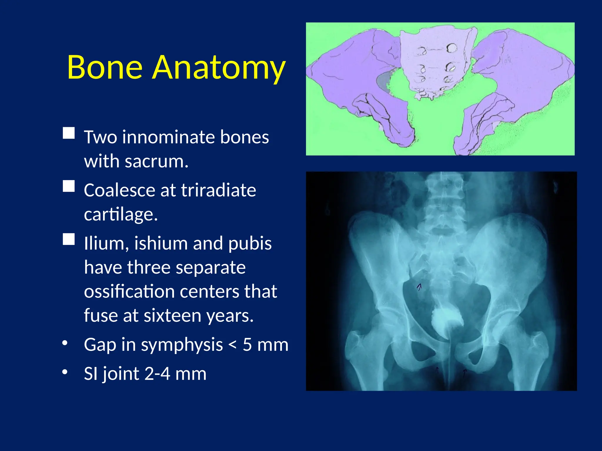 MANAGEMENT OF PELVIC FRACTUREMANAGEMENT OF PELVIC FRACTUREMANAGEMENT OF ...