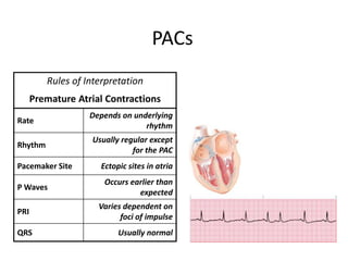 Management of peri arrest arrhythmias | PPTX