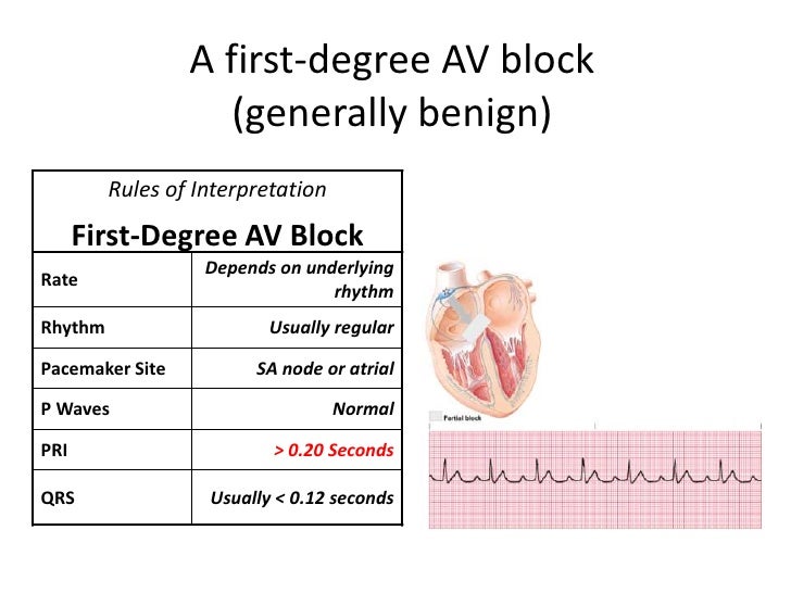 Management of peri arrest arrhythmias
