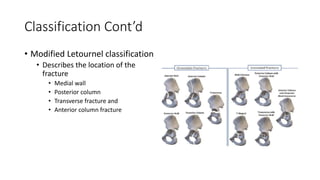 Jude Letournel Classification management of peri-prosthetic final.pptx