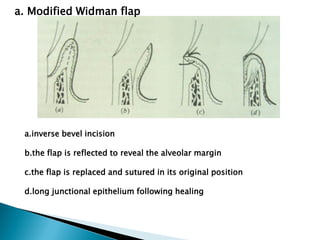 management of periodontal cases by dentistry | PDF