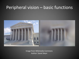Management of peripheral vision loss | PPTX
