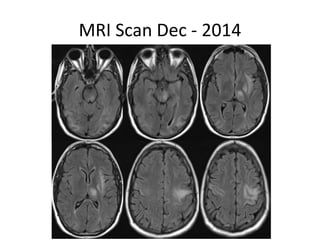 MRI Scan Dec - 2014
 