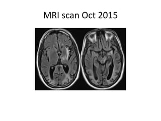 MRI scan Oct 2015
 