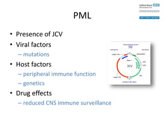 PML
• Presence of JCV
• Viral factors
– mutations
• Host factors
– peripheral immune function
– genetics
• Drug effects
– reduced CNS immune surveillance
 