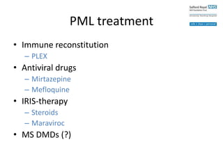 PML treatment
• Immune reconstitution
– PLEX
• Antiviral drugs
– Mirtazepine
– Mefloquine
• IRIS-therapy
– Steroids
– Maraviroc
• MS DMDs (?)
 