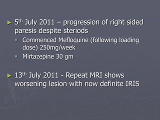 ► 5th July 2011 – progression of right sided
paresis despite steriods
 Commenced Mefloquine (following loading
dose) 250mg/week
 Mirtazepine 30 gm
► 13th July 2011 - Repeat MRI shows
worsening lesion with now definite IRIS
 
