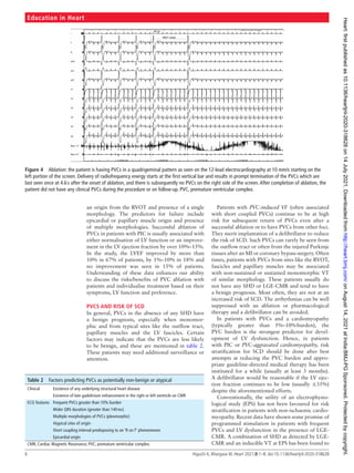 Management of premature ventricular complexes | PDF