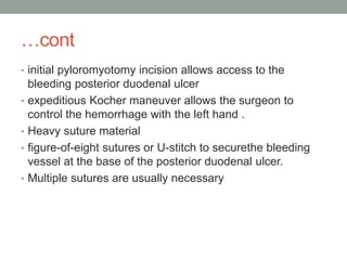 …cont
• initial pyloromyotomy incision allows access to the
bleeding posterior duodenal ulcer
• expeditious Kocher maneuver allows the surgeon to
control the hemorrhage with the left hand .
• Heavy suture material
• figure-of-eight sutures or U-stitch to securethe bleeding
vessel at the base of the posterior duodenal ulcer.
• Multiple sutures are usually necessary
 