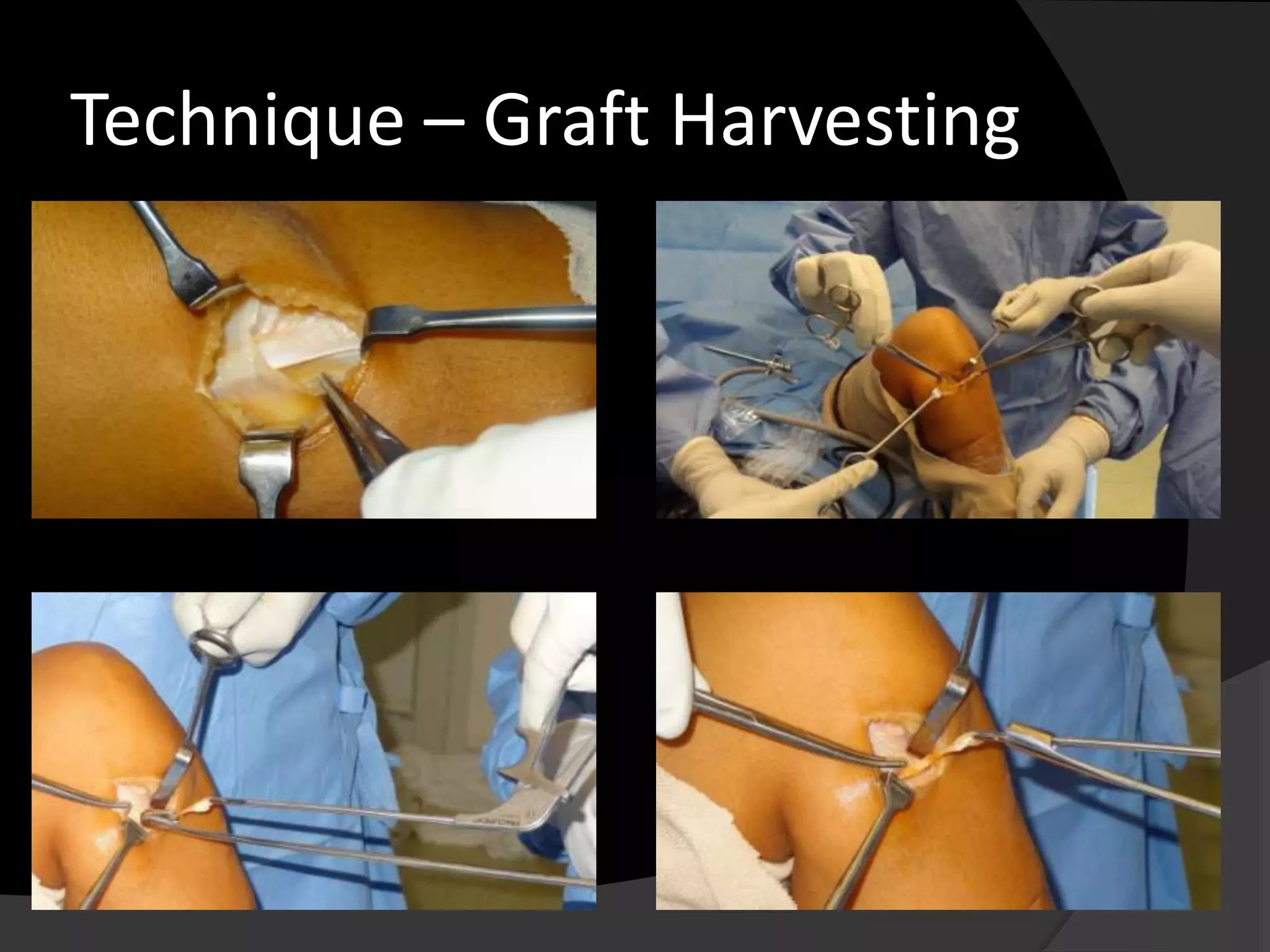 Technique – Graft Harvesting
 