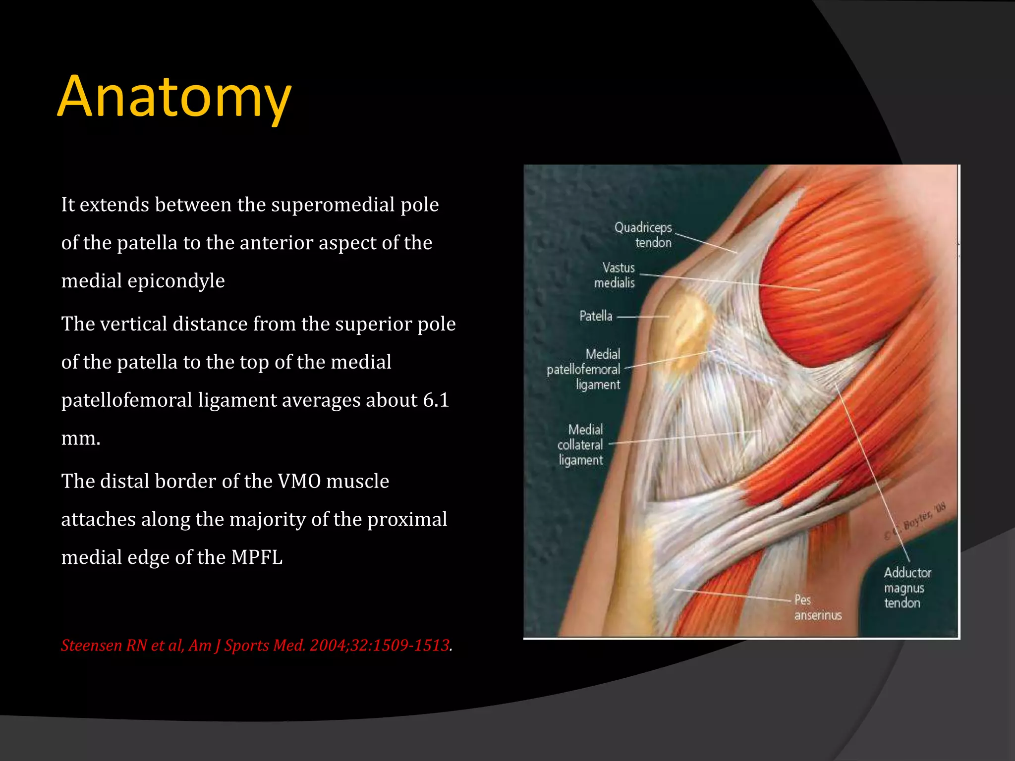 Anatomy
It extends between the superomedial pole
of the patella to the anterior aspect of the
medial epicondyle

The vertical distance from the superior pole
of the patella to the top of the medial
patellofemoral ligament averages about 6.1
mm.

The distal border of the VMO muscle
attaches along the majority of the proximal
medial edge of the MPFL



Steensen RN et al, Am J Sports Med. 2004;32:1509-1513.
 