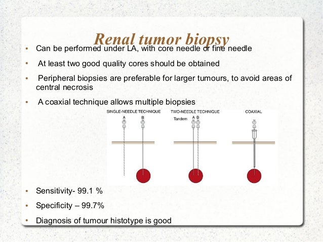 Management Of Renal Cell Carcinoma And Wilms Tumor