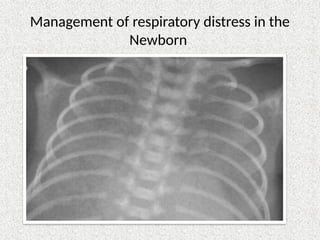 Management of respiratory distress in the newborn.pptx
