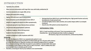 Management of small cell lung cancer | PPTX