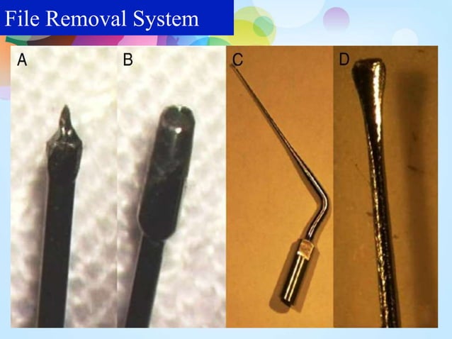 Management of seperated instruments- Dr.Jagadeesh kodityala | PPTX