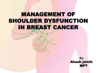 MANAGEMENT OF
SHOULDER DYSFUNCTION
IN BREAST CANCER
By:
Akash jainth
MPT
 