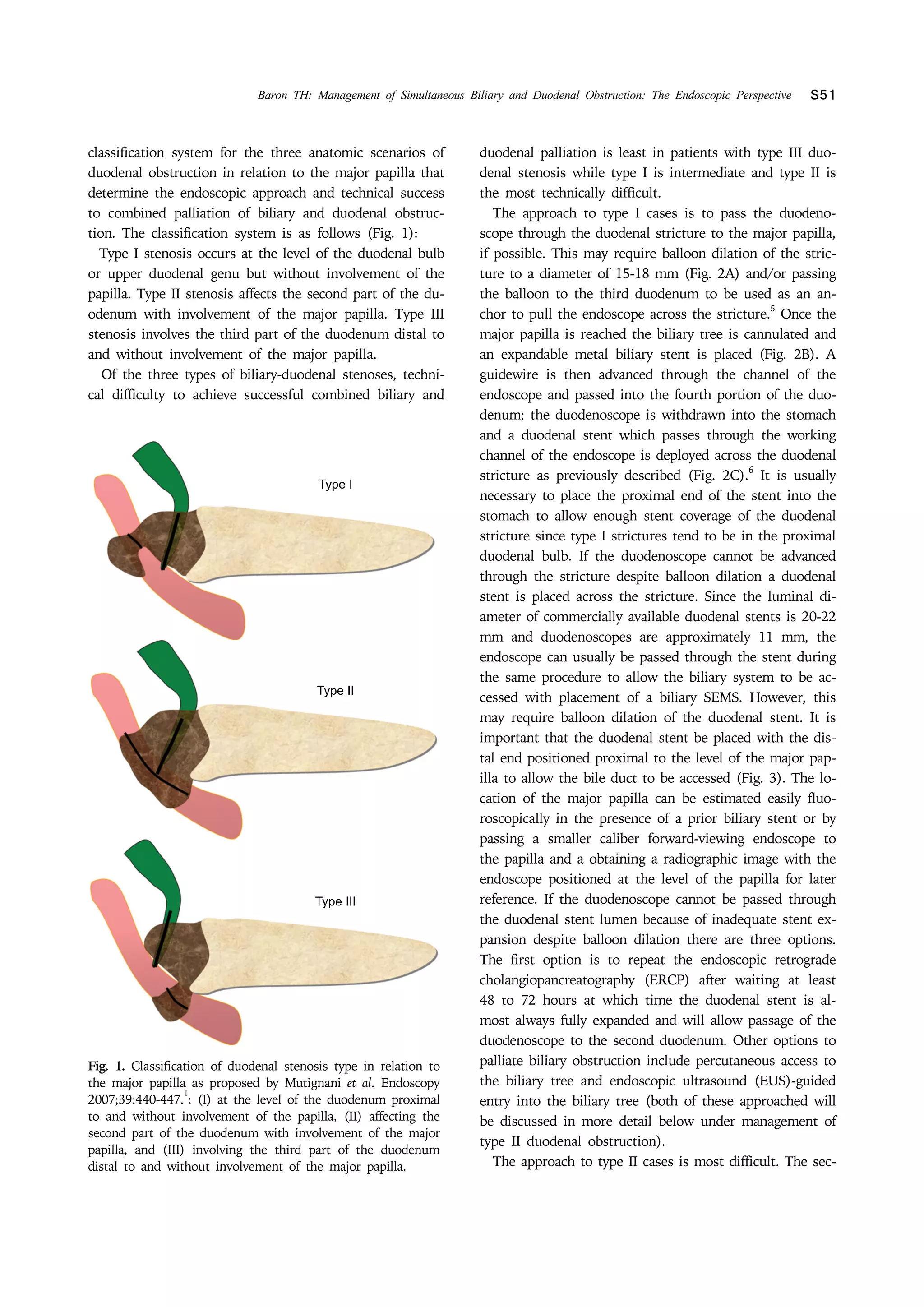 Management of simultaneous biliary and duodenal obstruction the ...