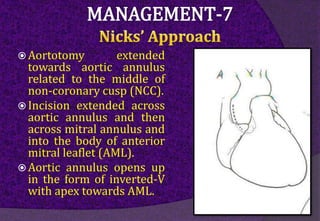  Aortotomy extended
towards aortic annulus
related to the middle of
non-coronary cusp (NCC).
 Incision extended across
aortic annulus and then
across mitral annulus and
into the body of anterior
mitral leaflet (AML).
 Aortic annulus opens up
in the form of inverted-V
with apex towards AML.
 